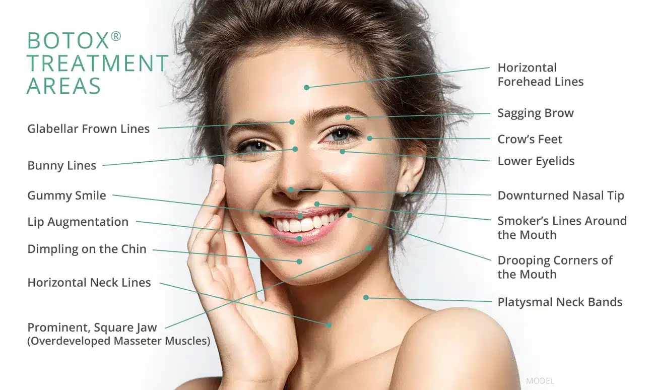 botox