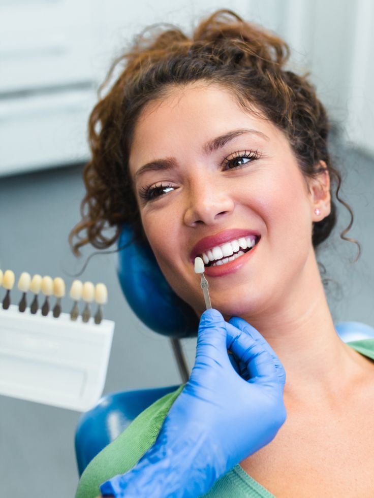 dental veneers performed on a patient in Willow Dental Care Vancouver