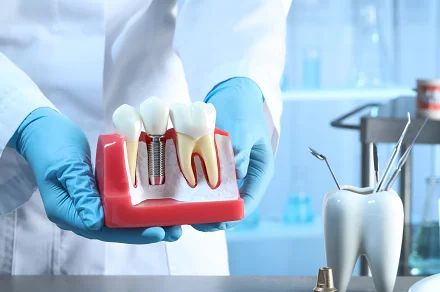 Types of Dental Implants