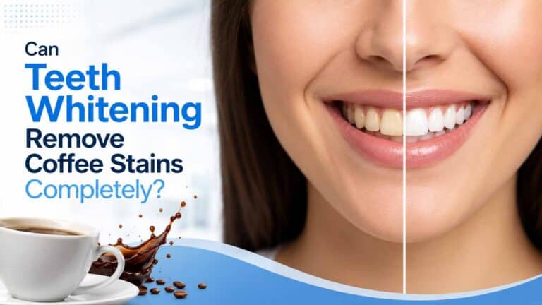 Can Teeth Whitening Remove Coffee Stains Completely