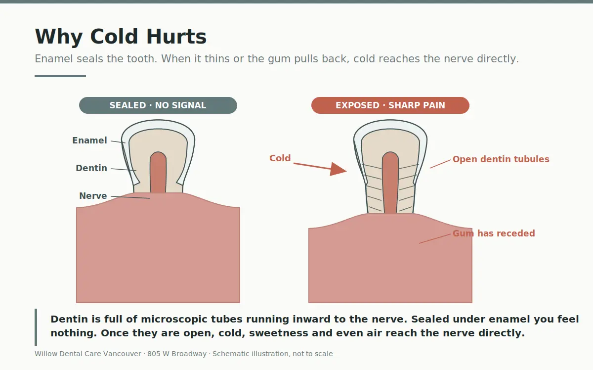 Why Cold Hurts